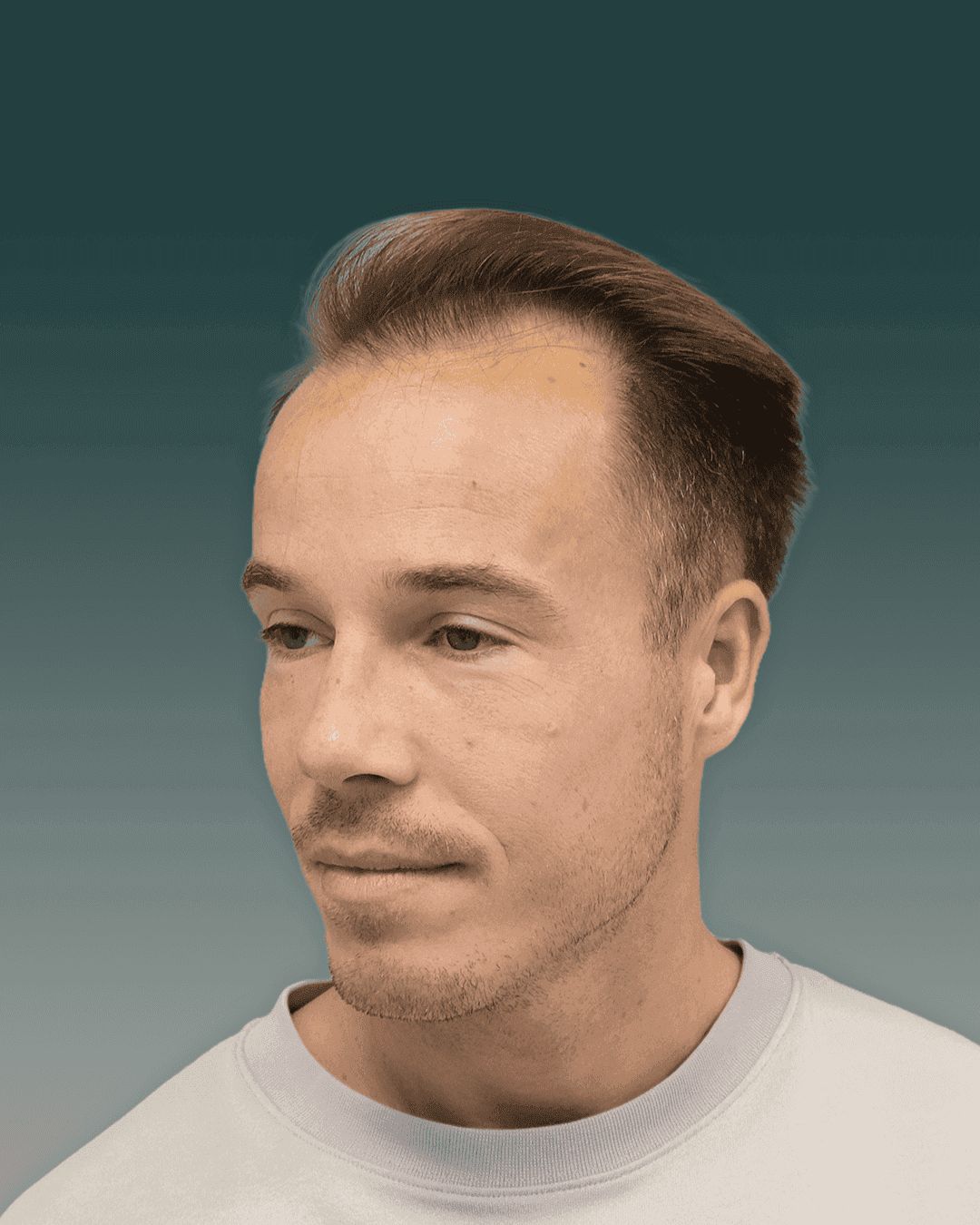 Resultat for Philip - før