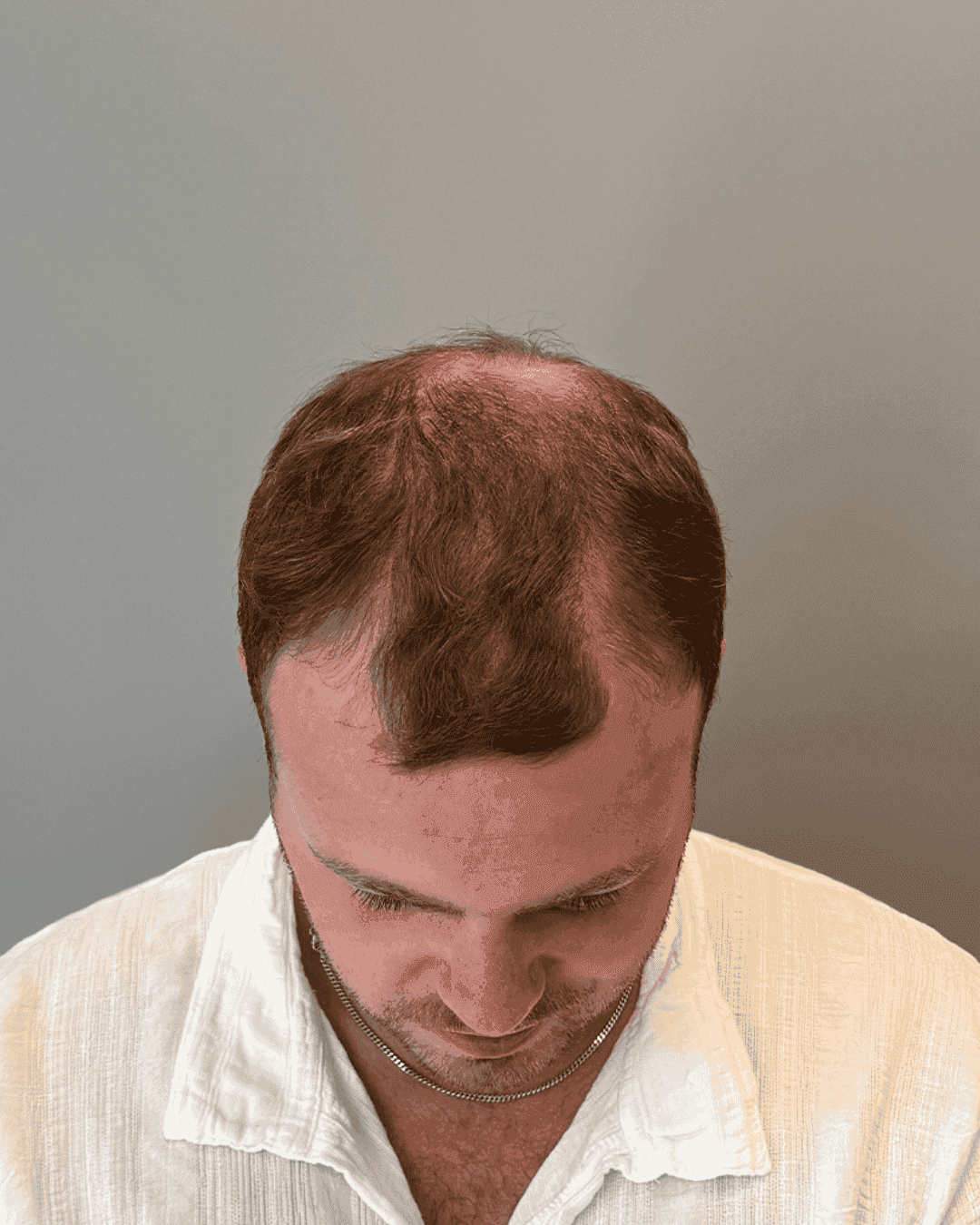 Resultat for Tobias - før