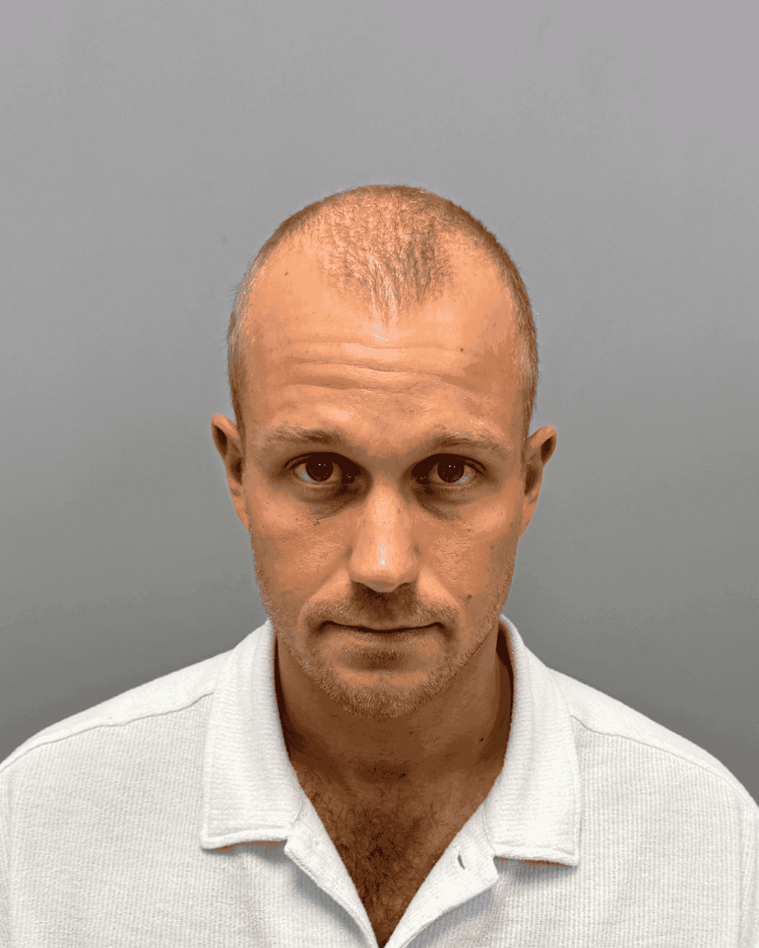 Resultat for Oliver - før