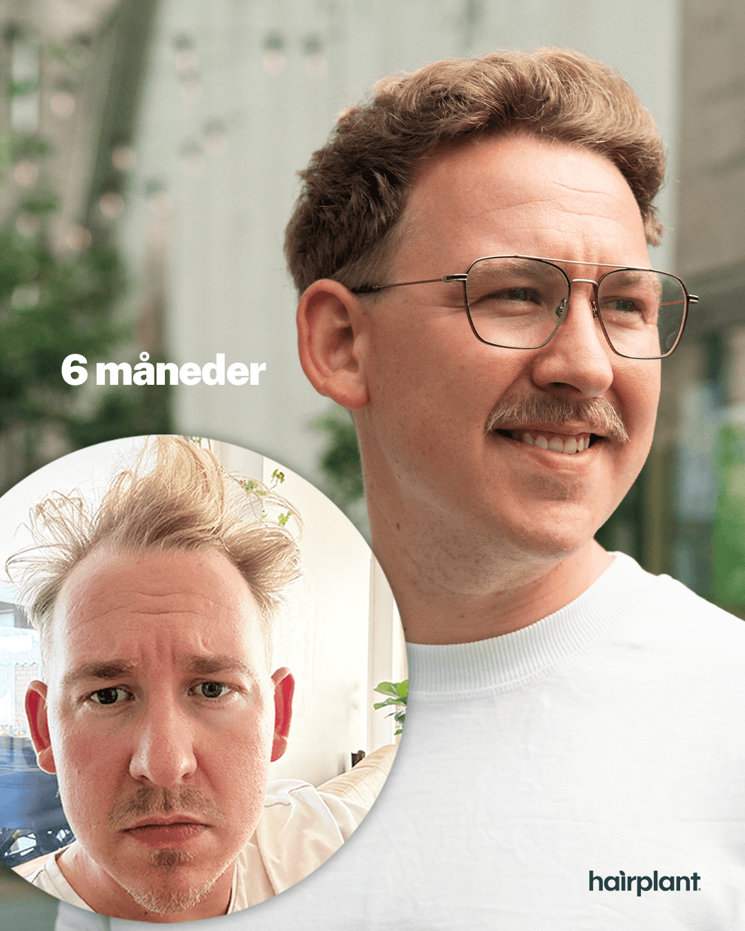 Resultat for Mads - efter