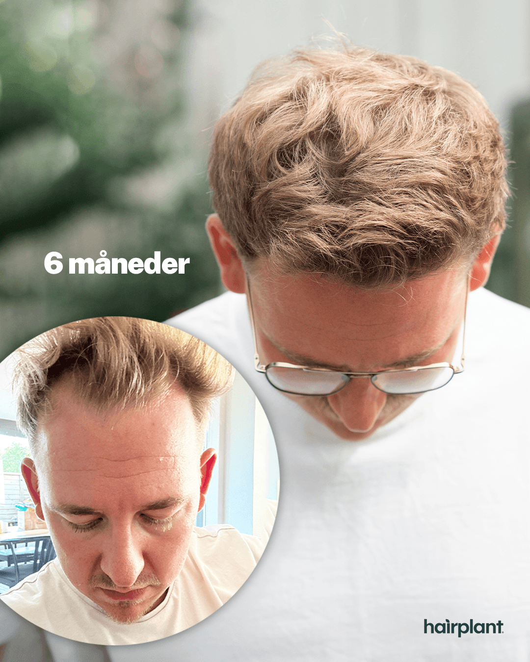 Resultat for Mads - før